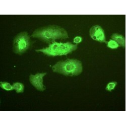 NAD(P)H Dehydrogenase, Quinone 1 (NQO1) Antibody