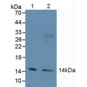 Western blot analysis of (1) Human HepG2 Cells and (2) Human Liver Tissue.