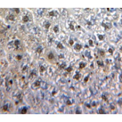 V-Myb Myeloblastosis Viral Oncogene Homolog (MYB) Antibody