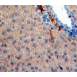 Interleukin 31 (IL31) Antibody