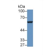 Western blot analysis of Mouse Placenta lysate, using Mouse IL9R Antibody (1 µg/ml) and HRP-conjugated Goat Anti-Rabbit antibody (<a href="https://www.abbexa.com/index.php?route=product/search&amp;search=abx400043" target="_blank">abx400043</a>, 0.2 µg/ml).