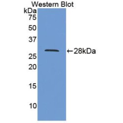 Interleukin 9 Receptor (IL9R) Antibody