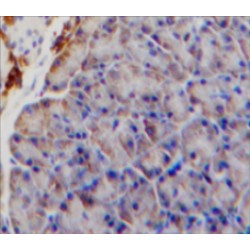 Interleukin 9 Receptor (IL9R) Antibody