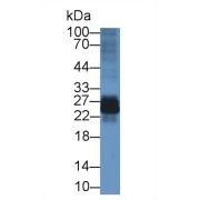 Western blot analysis of Rat Spleen lysate, using Mouse IL22Ra2 Antibody (3 µg/ml) and HRP-conjugated Goat Anti-Rabbit antibody (<a href="https://www.abbexa.com/index.php?route=product/search&amp;search=abx400043" target="_blank">abx400043</a>, 0.2 µg/ml).