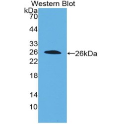 Interleukin 22 Receptor Alpha 2 (IL22Ra2) Antibody