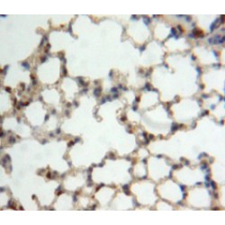 Interleukin 22 Receptor Alpha 2 (IL22Ra2) Antibody