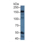 Western blot analysis of Mouse Cerebrum lysate, using Mouse NOS1 Antibody (1 µg/ml) and HRP-conjugated Goat Anti-Rabbit antibody (<a href="https://www.abbexa.com/index.php?route=product/search&amp;search=abx400043" target="_blank">abx400043</a>, 0.2 µg/ml).