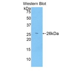 A Disintegrin And Metalloproteinase With Thrombospondin 12 (ADAMTS12) Antibody