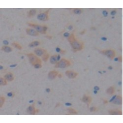 A Disintegrin And Metalloproteinase With Thrombospondin 12 (ADAMTS12) Antibody