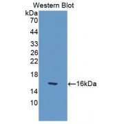 Western blot analysis of the recombinant protein.