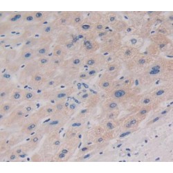 Interleukin 17A (IL17A) Antibody