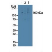 Western blot analysis of (1) Mouse Liver Tissue, (2) Mouse Placenta Tissue and (3) Mouse Spleen Tissue.
