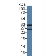 Western blot analysis of Mouse Lung lysate, using Mouse LDLRAP1 Antibody (1 µg/ml) and HRP-conjugated Goat Anti-Rabbit antibody (<a href="https://www.abbexa.com/index.php?route=product/search&amp;search=abx400043" target="_blank">abx400043</a>, 0.2 µg/ml).