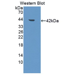 Low Density Lipoprotein Receptor Adaptor Protein 1 (LDLRAP1) Antibody