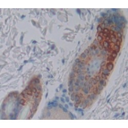 Low Density Lipoprotein Receptor Adaptor Protein 1 (LDLRAP1) Antibody