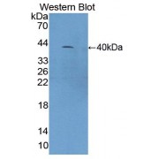 Western blot analysis of recombinant Mouse C4a.