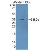 Western blot analysis of the recombinant protein.