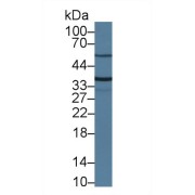 Western blot analysis of Mouse Kidney lysate, using Mouse TMPRSS2 Antibody (1 µg/ml) and HRP-conjugated Goat Anti-Rabbit antibody (<a href="https://www.abbexa.com/index.php?route=product/search&amp;search=abx400043" target="_blank">abx400043</a>, 0.2 µg/ml).