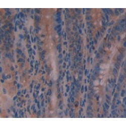 Transmembrane Protease, Serine 2 (TMPRSS2) Antibody