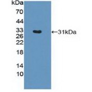 Western blot analysis of recombinant Mouse HLA-DRB1.