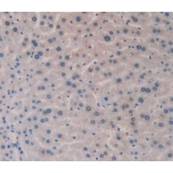 HLA Class II Histocompatibility Antigen, DRB1 Beta Chain (HLA-DRB1) Antibody