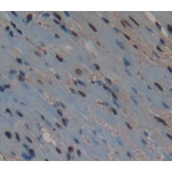 Cyclic AMP-Dependent Transcription Factor ATF-3 (ATF3) Antibody