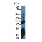 Western blot analysis of Mouse Cerebrum lysate, using Mouse GH Antibody (2 µg/ml) and HRP-conjugated Goat Anti-Rabbit antibody (<a href="https://www.abbexa.com/index.php?route=product/search&amp;search=abx400043" target="_blank">abx400043</a>, 0.2 µg/ml).
