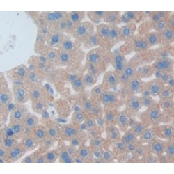 Somatotropin (GH1) Antibody