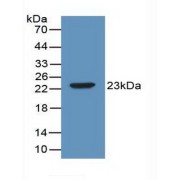 Western blot analysis of recombinant Mouse IL2.