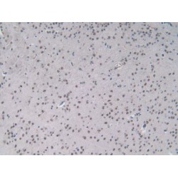 Interleukin 2 (IL2) Antibody