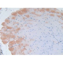 Interleukin 2 (IL2) Antibody