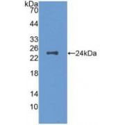 Western blot analysis of recombinant Mouse MCSF.