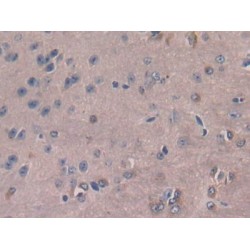 Colony Stimulating Factor 1, Macrophage (MCSF) Antibody