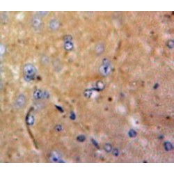 Colony Stimulating Factor 1, Macrophage (MCSF) Antibody