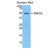 Western blot analysis of the recombinant protein.