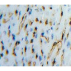 Tissue Factor Pathway Inhibitor (TFPI) Antibody