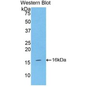 Western blot analysis of the recombinant protein.