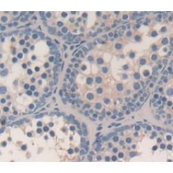 Inhibin Alpha (INHA) Antibody