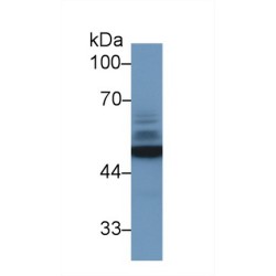 Enolase, Neuron Specific (NSE) Antibody