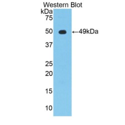 Enolase, Neuron Specific (NSE) Antibody