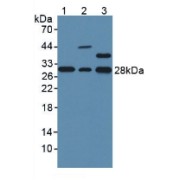 Western blot analysis of (1) Mouse Liver Tissue, (2) Mouse Heart Tissue and (3) Mouse Lung Tissue.