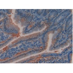 Glutathione S Transferase Omega 1 (GSTo1) Antibody