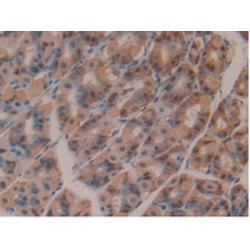 Glutathione S Transferase Omega 1 (GSTo1) Antibody