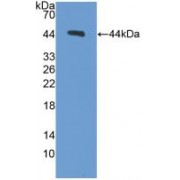 Western blot analysis of recombinant Mouse PCT.