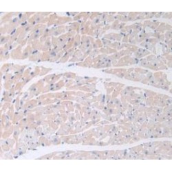 Procalcitonin (PCT) Antibody