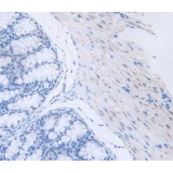 Procalcitonin (PCT) Antibody