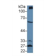 Western blot analysis of Mouse Kidney lysate, using Mouse PCX Antibody (5 µg/ml) and HRP-conjugated Goat Anti-Rabbit antibody (<a href="https://www.abbexa.com/index.php?route=product/search&amp;search=abx400043" target="_blank">abx400043</a>, 0.2 µg/ml).