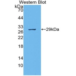 Podocalyxin (PODXL) Antibody