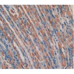 Chemerin (RARRES2) Antibody