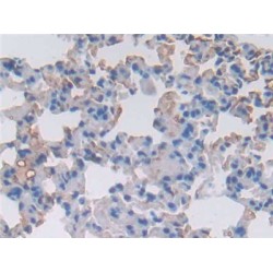 Serine Protease Inhibitor A3N (SERPINA3N) Antibody